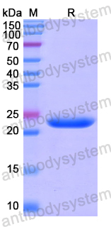 Recombinant Human SMAD4 Protein, N-His