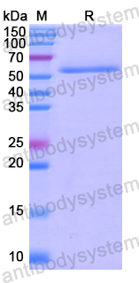 Recombinant Human BIRC2 Protein, N-GST