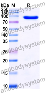 Recombinant Human BIRC2 Protein, N-GST
