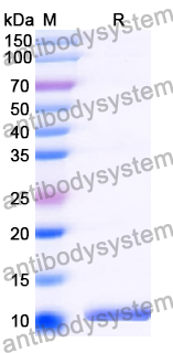 Recombinant Human BIRC2 Protein, N-His