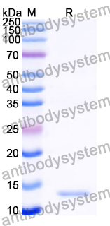 Recombinant Human BIRC2 Protein, N-His