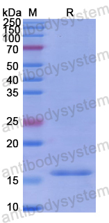Recombinant Human SQSTM1 Protein, N-His