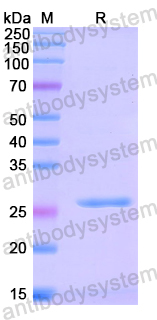 Recombinant Human MTX1 Protein, N-His