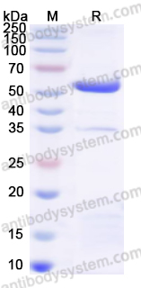 Recombinant Human TUBB3 Protein, C-His