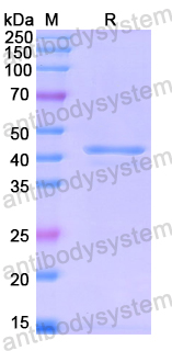 Recombinant Human ASAH1 Protein, N-His