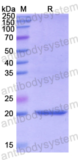 Recombinant Human PNOC Protein, N-His