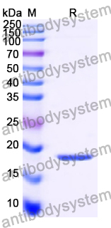 Recombinant Human PIN1 Protein, C-His