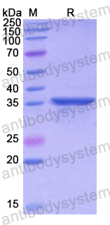 Recombinant Human ATR Protein, N-His