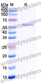 Recombinant Human HDAC1 Protein, N-His