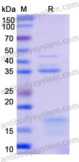 Recombinant Human CAMK2B Protein, N-His