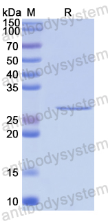 Recombinant Human PKD2 Protein, N-His