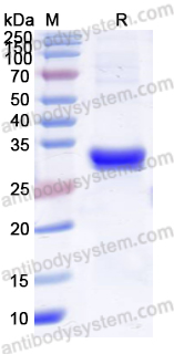 Recombinant Human IRF5 Protein, N-His