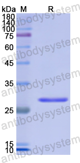 Recombinant Human DGKZ Protein, N-His