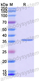 Recombinant Human DGKZ Protein, N-His-SUMO