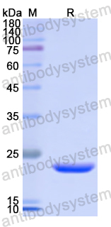 Recombinant Human STIM1 Protein, N-His