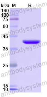 Recombinant Human SEMA5A Protein, N-His