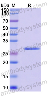 Recombinant Human CUL4B Protein, N-His