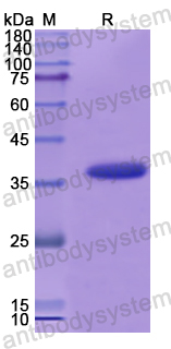 Recombinant Human TPBG Protein, N-His