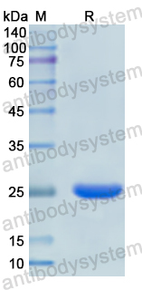 Recombinant Human CACNA1S Protein, N-His