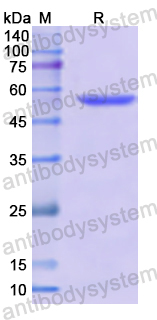 Recombinant Human CD166/ALCAM Protein, N-His