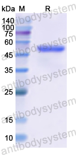 Recombinant Human LAMB3 Protein, N-GST