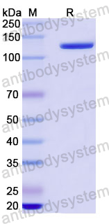 Recombinant Human LAMB3 Protein, N-His