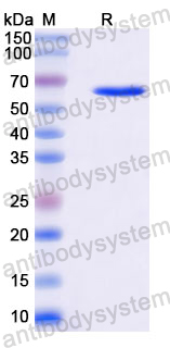 Recombinant Human LAMB3 Protein, N-His