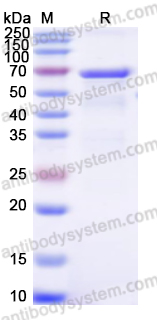 Recombinant Human LAMB3 Protein, N-His