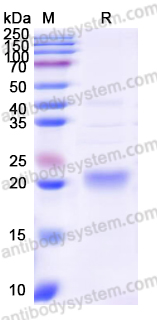Recombinant Human LAMC2 Protein, N-His