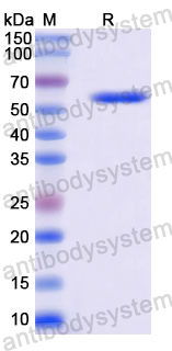 Recombinant Human LAMC2 Protein, N-His