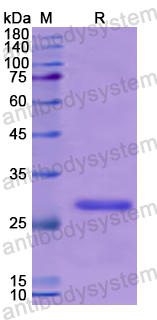 Recombinant Human ENPP2 Protein, N-His