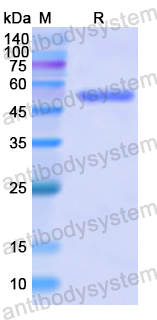 Recombinant Human PKP1 Protein, N-GST