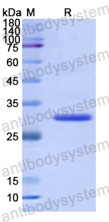 Recombinant Human PTK6 Protein, N-His