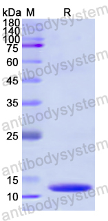 Recombinant Human KLF5 Protein, N-His