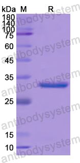 Recombinant Human RAPGEF1 Protein, N-His