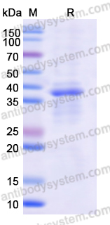 Recombinant Human PRKG1 Protein, N-His