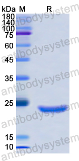 Recombinant Human CKAP5 Protein, N-His
