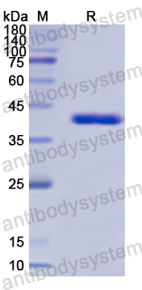 Recombinant Human CAMK1 Protein, N-His