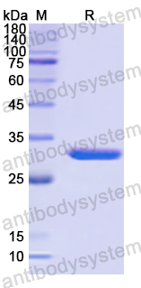 Recombinant Human NID2 Protein, N-His