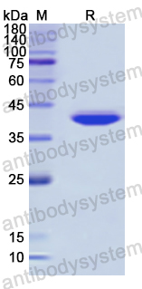 Recombinant Human PDE1C Protein, N-His