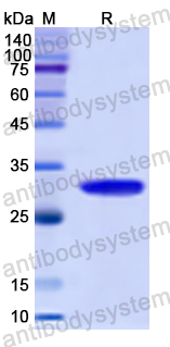 Recombinant Human DSG2 Protein, N-His
