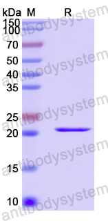 Recombinant Human TRIM29 Protein, N-His-SUMO