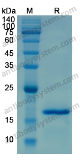 Recombinant Human KEAP1 Protein, N-His