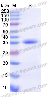 Recombinant Human KEAP1 Protein, N-His