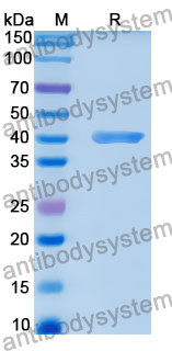 Recombinant Human GIT2 Protein, N-His