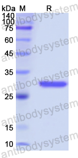 Recombinant Human MPP2 Protein, N-His