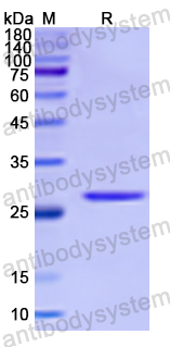 Recombinant Human DOC2A Protein, N-His