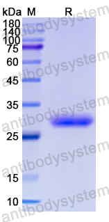 Recombinant Human DOC2B Protein, N-His
