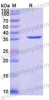 Recombinant Human DCTN1 Protein, N-His