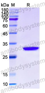 Recombinant Human DYNC1H1 Protein, N-His